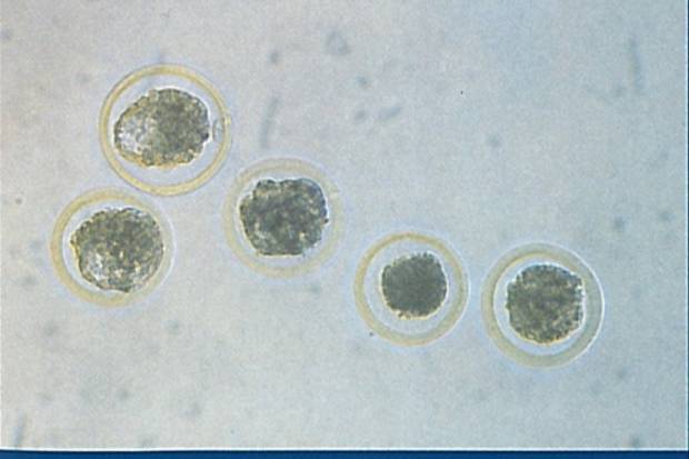 Embryo Transfer